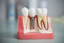 стоматология в Балашихе 4